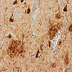 Illustration for article titled Can Science See Inside An NFL Players Skull Before Its Too Late?